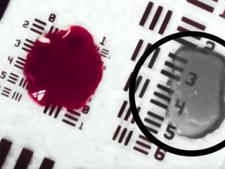 thumbnail - IA Cirurgia